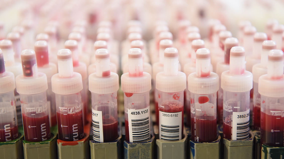 Zu sehen sind mehrere Bluttests in einem Labor.